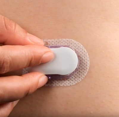Kako i gdje na tijelu postaviti Medtrum CGM? (VIDEO demonstracija)