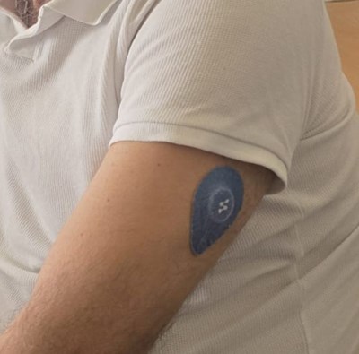 Iskustvo korisnika: Syai X1 senzor donio mi je mir, bolji san i kontrolu nad šećerom