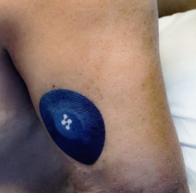 Iskustvo korisnika: Syai X1 CGM – jednostavnija kontrola i mirniji svakodnevni život