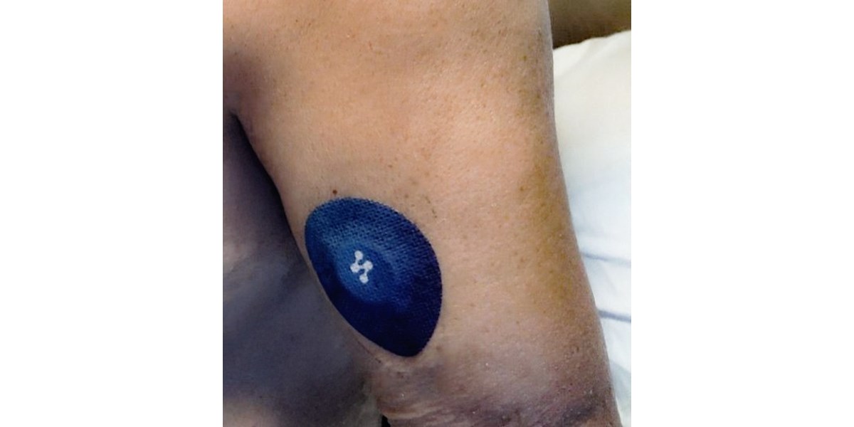 Iskustvo korisnika: Syai X1 CGM – jednostavnija kontrola i mirniji svakodnevni život