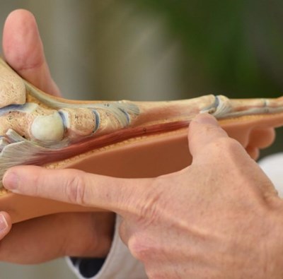 b:joynz Night Splint ortoza kao učinkovita pomoć kod plantarnog fascitisa