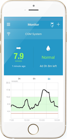 CGM System